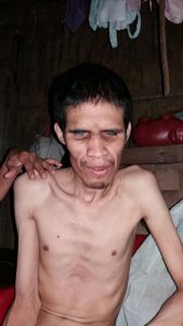 Verolis, invidente y con discapacidad sicomotriz - foto familiar