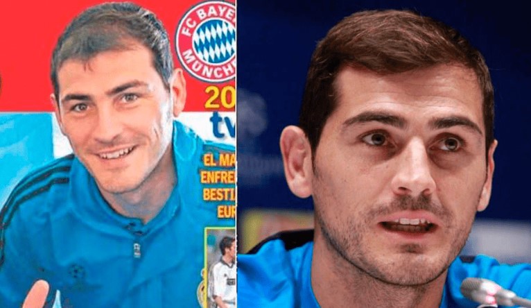 12 famosos que se han sometido a trasplantes capilares - Iker Casillas