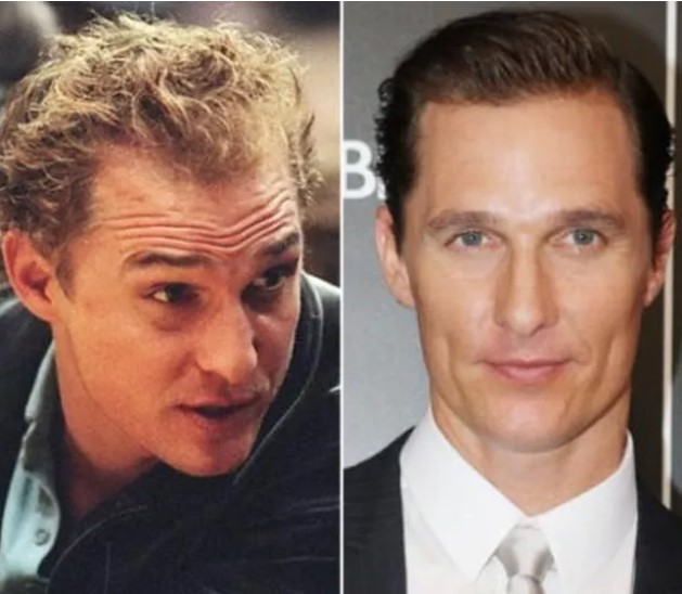 12 famosos que se han sometido a trasplantes capilares - Matthew McConaughey