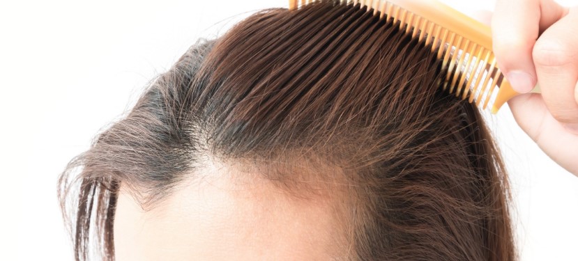 Señales alarmantes que indican que la caída de tu pelo es grave