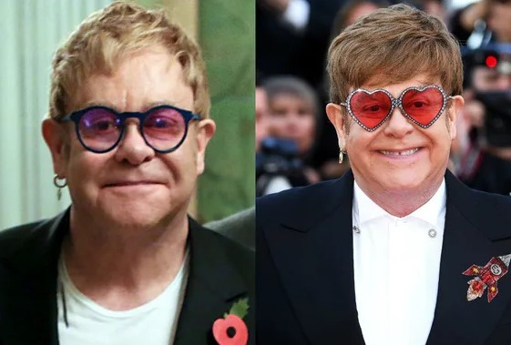 12 famosos que se han sometido a trasplantes capilares - Elton John